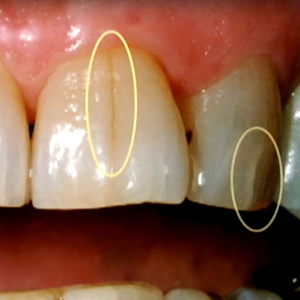 انواع حوادث دندانی