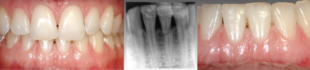 انواع حوادث دندانی