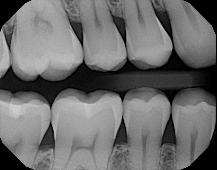 تصاویر رادیوگرافی در دندانپزشکی