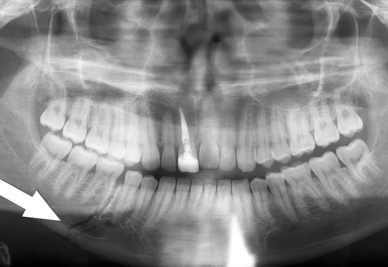 تصاویر رادیوگرافی در دندانپزشکی